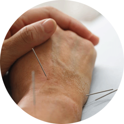 services acupuncture moxa ventouses réflexologie plantaire