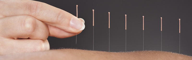 acupuncture Thierry Gonidec exemple